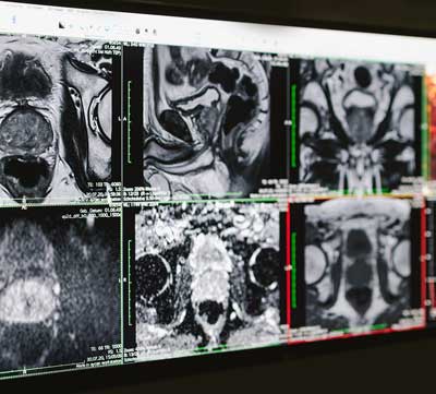 Schmerz- & Strahlentherapie, Vorsorgediagnostik | Mammografie | Radiologie Heinrichsallee