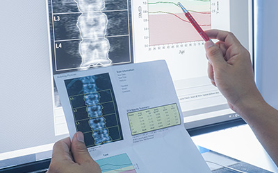 Knochendichtemessung in der Radiologie Heinrichsallee