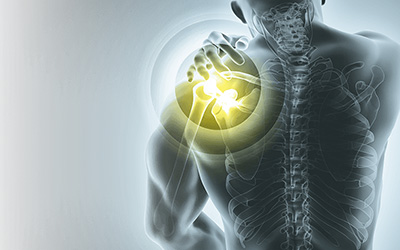 Tumordiagnostik, Sport-/ Bewegungsdiagnostik | Mammografie | Radiologie Heinrichsallee