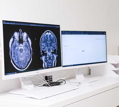 Computerbildschirm Aufnahmen Neuroradiologie Aachen