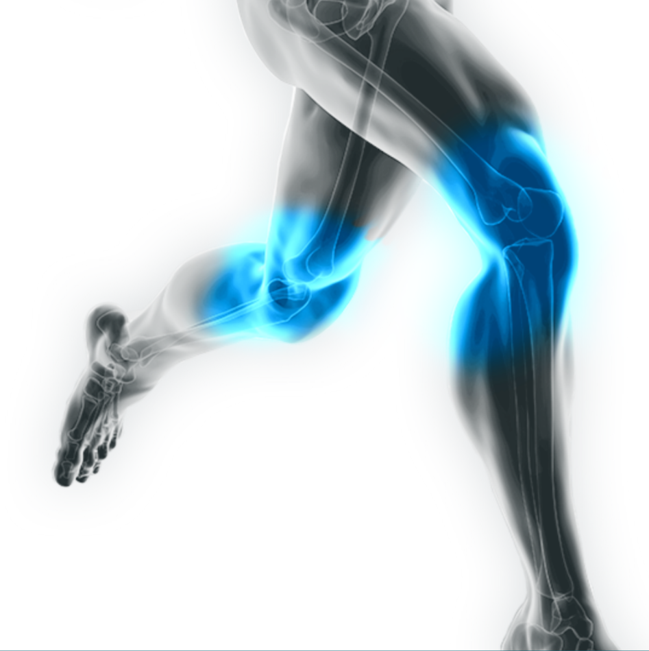 Grafik von laufenden Beinen eines Sportlers. Der Bereich an den Knien leuchtet blau.